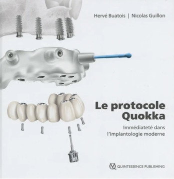 Le protocole Quokka immédiateté dans l'implantologie moderne